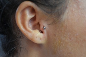 Right Tragus